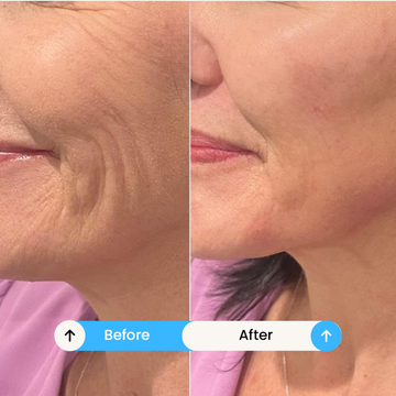 Centellian Retinol Tightening Cream – 2X PDRN™ + 3D Retinol™ + Phyto Collagen – Firms Skin, Reduces Fine Lines & Deeply Hydrates – 360° All-Around Eye Lifting Care