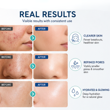 WishCare NMF Water Gel | Controls Excess Oil | Deep 24H Hydration | Strengthens Skin Barrier