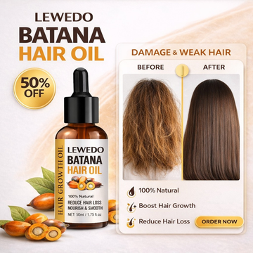 LEWEDO Batana Hair Oil – 100% Natural – Reduces Hair Loss, Boosts Hair Growth, Nourishes & Smooths, Eliminates Dandruff – For Dry, Damaged & Weak Hair