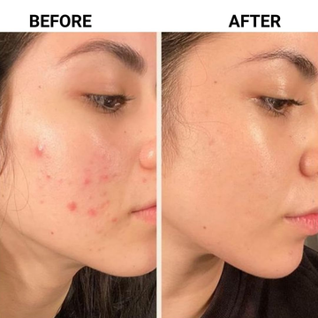 Mixsoon Bean Essence | 2-in-1 Exfoliating & Hydrating Essence with Fermented Soybean, Barley, Pomegranate & Korean Pear | Smooths Texture, Controls Sebum & Adds Natural Glow