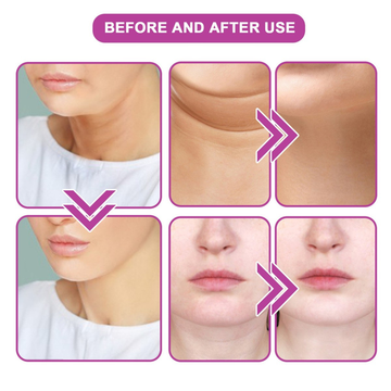Rozino Neck Firming Lifting Cream | Sodium Hyaluronate + Collagen Complex 5% | Reduces Neck Wrinkles, Tightens Sagging Skin & Restores Elasticity