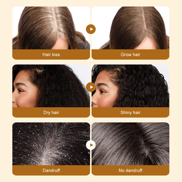 LEWEDO Batana Hair Oil – 100% Natural – Reduces Hair Loss, Boosts Hair Growth, Nourishes & Smooths, Eliminates Dandruff – For Dry, Damaged & Weak Hair